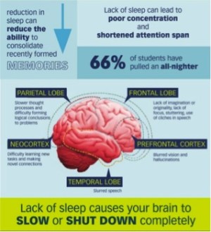 This is your brain, without sleep.